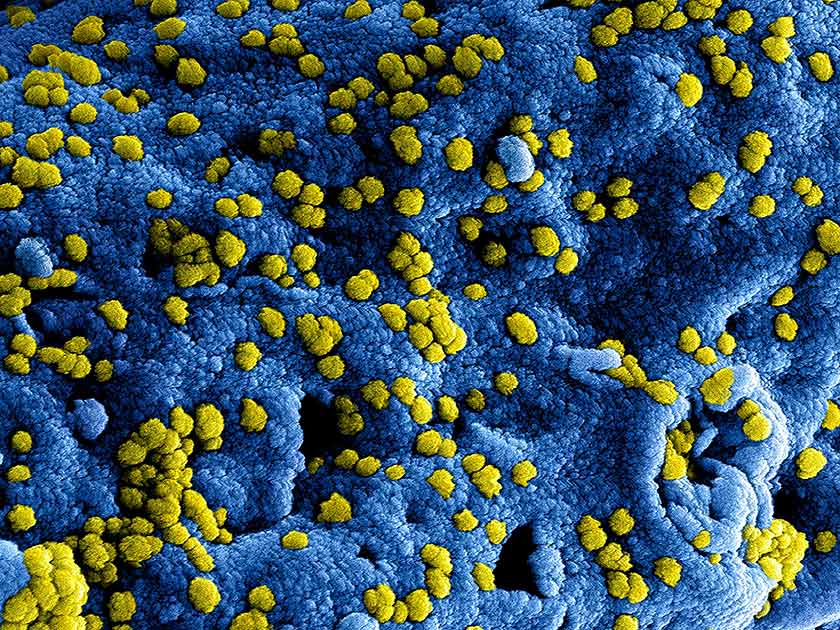 Are Air Purifiers Effective Against Viruses and Bacteria?